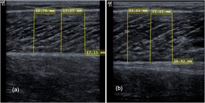 Sex differences in stretch-induced hypertrophy, maximal strength and flexibility gains